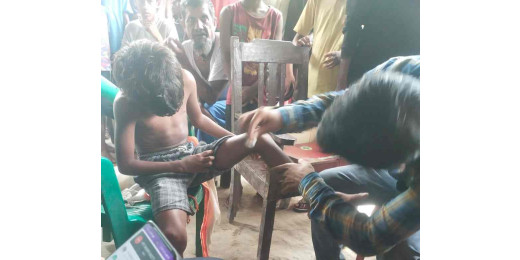 शेरपुर बंगरा इलाके में गीदड़ ने लोगों को काटा
